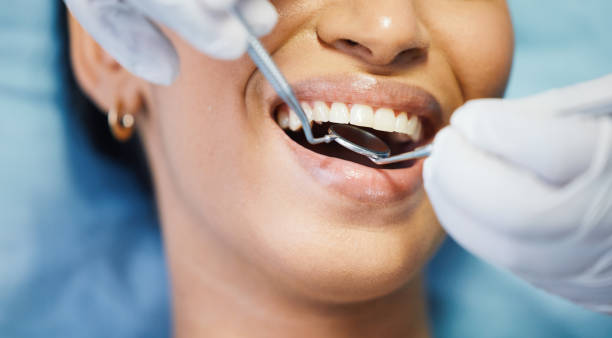 Best 24-Hour Emergency Dentist in Fox Island, WA