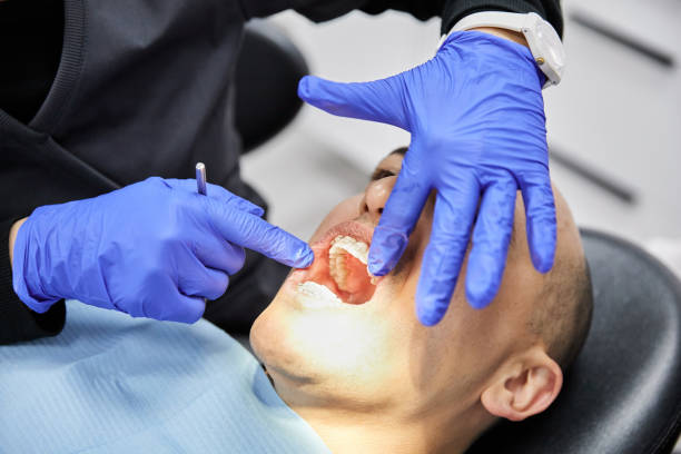 Best Emergency Wisdom Teeth Removal in Fox Island, WA